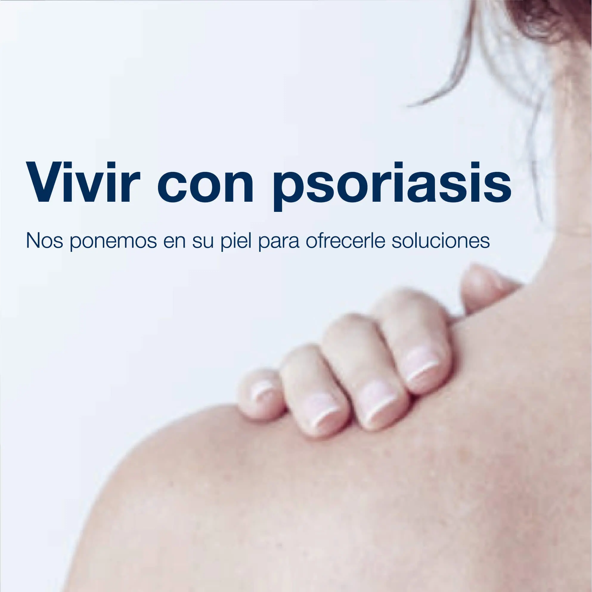 vivir-con-psoriasis