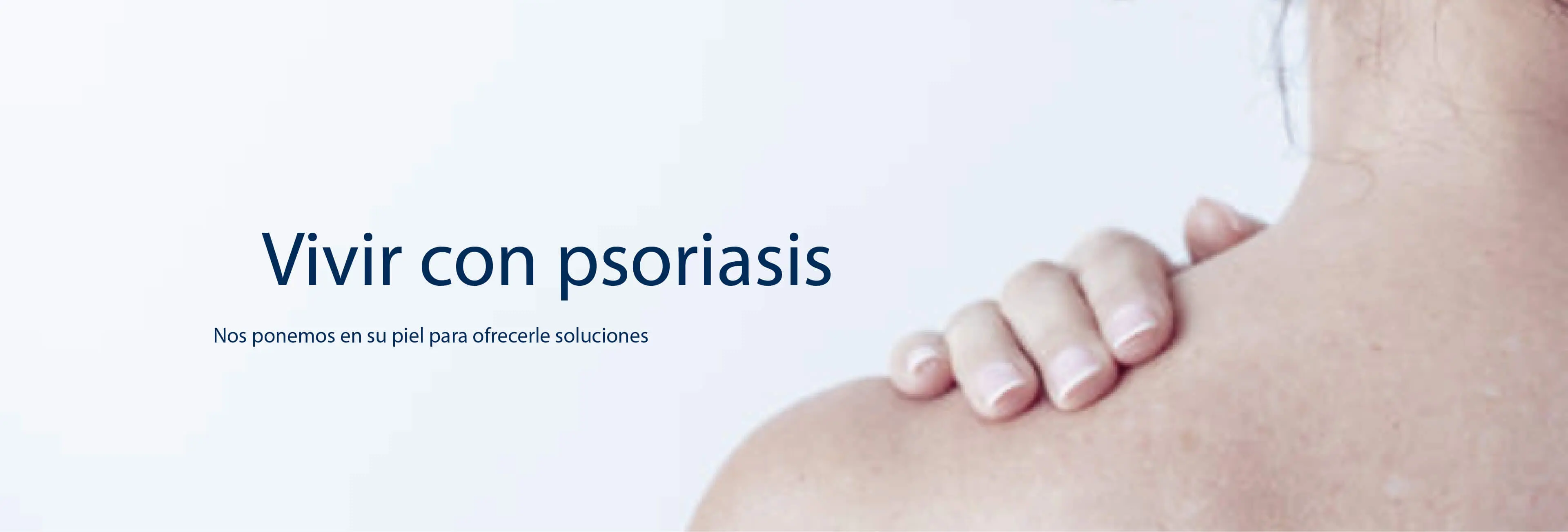 vivir-con-psoriasis
